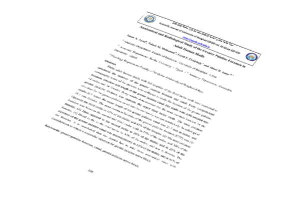 Anatomical and Radiological Study of the Greater Palatine Foramen in Adult Human Skulls